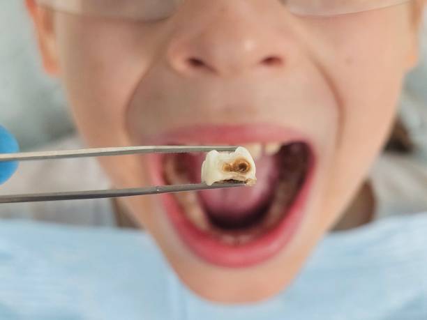 Best Pediatric Emergency Dentist in New Port Richey, FL
